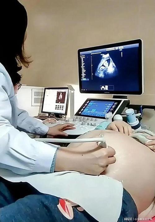 孕检b超视频,宝宝成长轨迹全记录